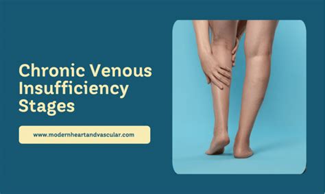 Chronic Venous Insufficiency Stages - Modern Heart and Vascular