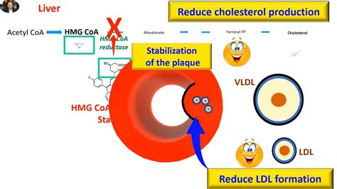 Statins, cholesterol and atherosclerosis - YouTube