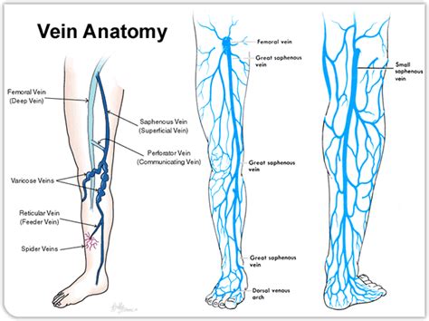 Varicose Veins | Vascular Surgery