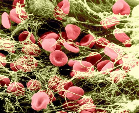 Fibrin | Blood Clotting, Coagulation, Thrombin | Britannica