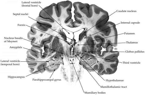 Amygdala Emotion Star Wars | Declarative memory, Human brain, Limbic system