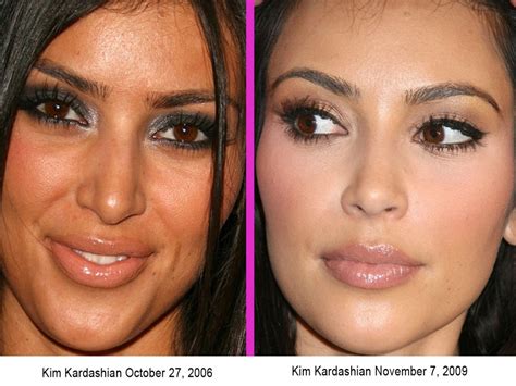 Before And After- Kim Kardashian (surgery Or Not) Pictures, Photos, and Images for Facebook ...