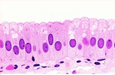 Epitelio simple | Histología, Celulas, Membrana basal