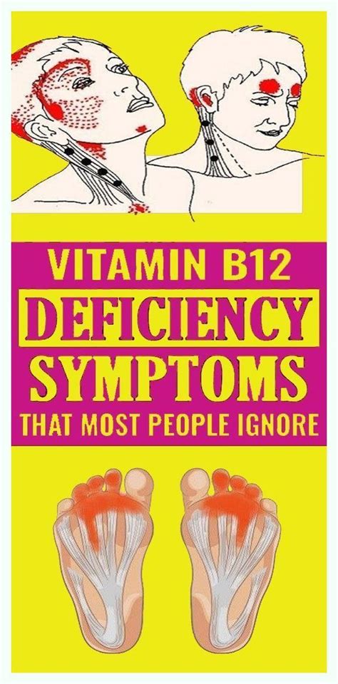 VITAMIN B12 DEFICIENCY SYMPTOMS THAT MOST PEOPLE IGNORE | Foods for brain health, Vitamin b12 ...
