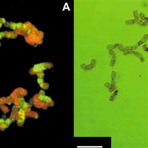 Successive Giemsa staining of the metaphase chromosomes after GISH. (A ...