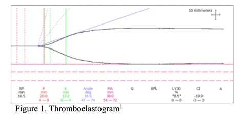 The Thromboelastogram (TEG®): A Five-Minute Primer for the Emergency Physician - emdocs