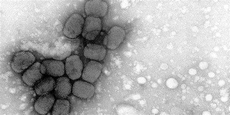 CDC: Smallpox Virus Samples Found In Lab Are Live | HuffPost