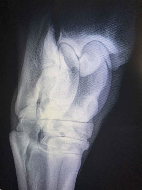 Equine X-ray of a normal hock joint