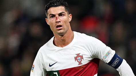 Ronaldo bloodied in Portugal match after brutal collision with Czech ...