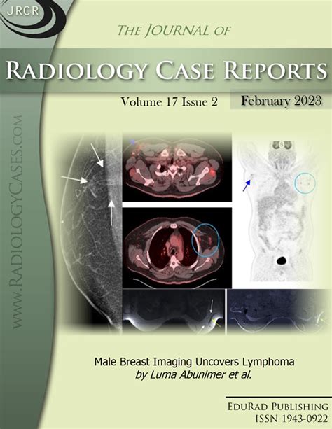 Journal of Radiology Case Reports