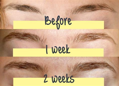 Brow Growth Serum | Brow growth serum, Brow growth, How to grow eyebrows