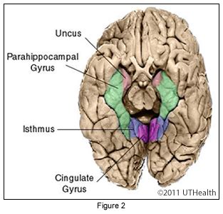 Neuroanatomy Online: Lab 1 - Overview of the Nervous System - Cerebral Lobes - Limbic System