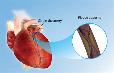 Health Condition : Symptoms, Causes, Treatment and More