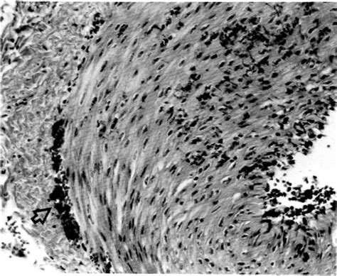 0 Dermal artery from 8-hour bovine active Arthus reaction. Adventitia... | Download Scientific ...