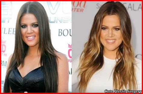 Khloe Kardashian Plastic Surgery Pictures - Celebrities Plastic Surgery