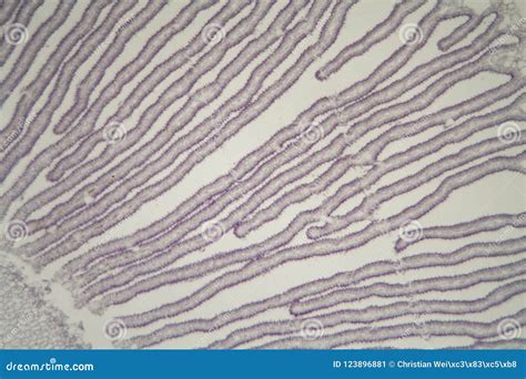 Coprinus Mushroom Under the Microscope Stock Image - Image of fungus ...