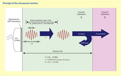 The physics of ultrasound - Anaesthesia & Intensive Care Medicine