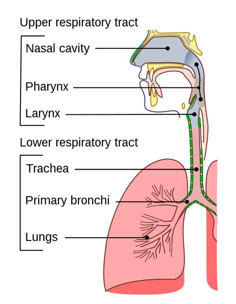 Lower respiratory tract infection - Wikipedia