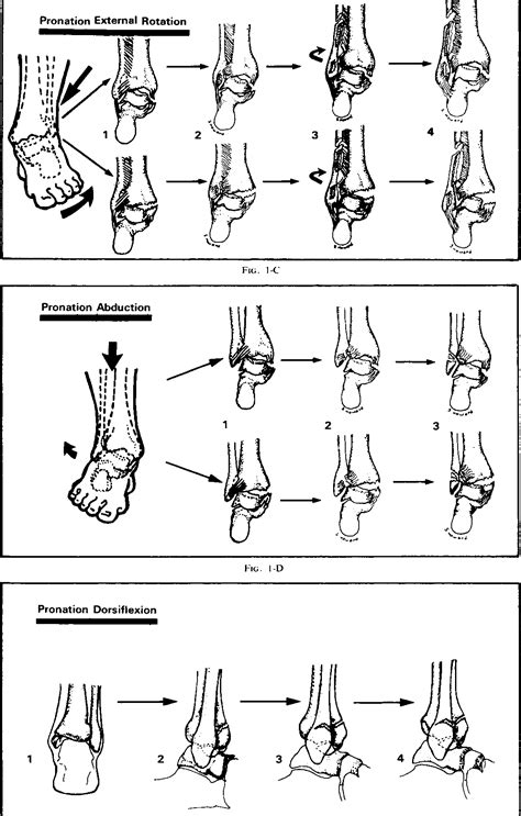 Distal tibiofibular joint structure | Semantic Scholar