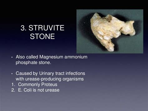 TYPES OF RENAL CALCULI