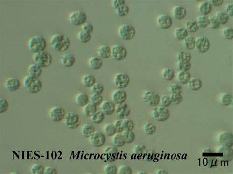 Microcystis aeruginosa Protists, Microorganisms, Algae, Produce, Stuffed Mushrooms, Templates ...