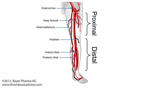 dvt model - Google Search | Physiology, Anatomy and physiology, Medical