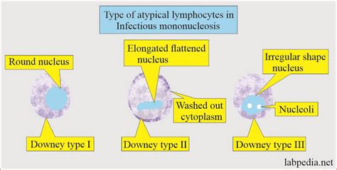 Epstein-Barr virus (EBV) and Infectious mononucleosis