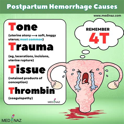 Medinaz - Postpartum haemorrhage Causes mnemonic . . . .... | Facebook