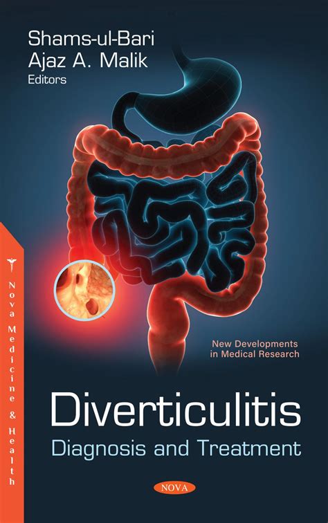 Diverticulitis: Diagnosis and Treatment – Nova Science Publishers