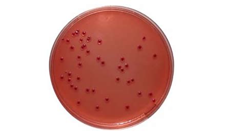 Yersinia Selective Agar: Introduction, Principle, Composition, Preparation