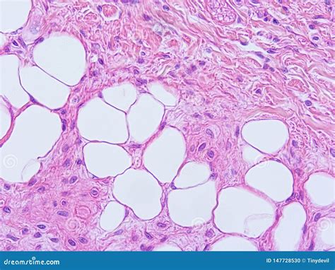 Histology Of Epiglottis Human Tissue Royalty-Free Stock Photography | CartoonDealer.com #147728741