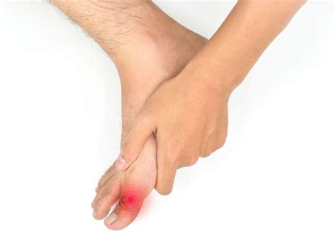 Hallux Rigidus Causes & Management Singapore - Straits Podiatry