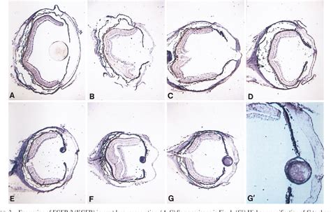 Figure 3 from Conservation of fibroblast growth factor function in lens regeneration. | Semantic ...