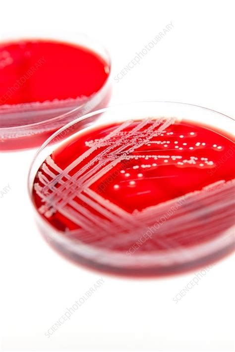 E. coli bacterial culture - Stock Image - C036/1199 - Science Photo Library