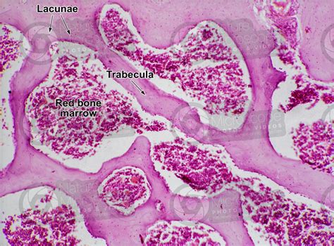 Mammal. Spongy osseous tissue. Femur. Transverse section. 125X - Spongy ...