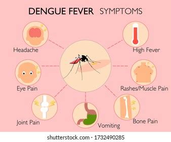 Dengue Fever Symptoms Infographic Mosquito Cause Stock Illustration ...