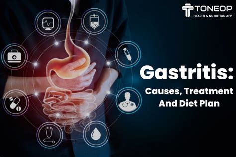 Gastritis: Causes, Treatment And Diet Plan | ToneOp