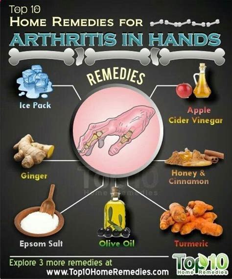 Home Remedies for Arthritis in Hands | Arthritis hands, Home remedies for arthritis, Natural ...