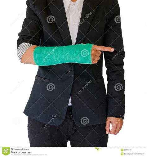 Closeup of a Broken Arm in a Cast Isolated on White Background Stock ...