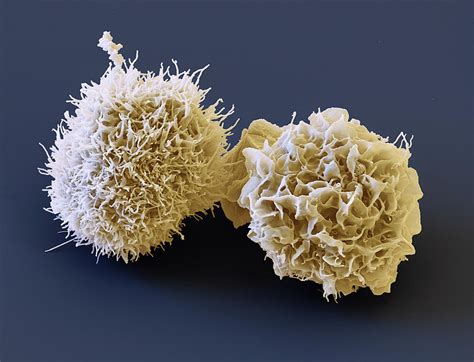 Dendritic Cells, Sem Photograph by Eye Of Science - Pixels