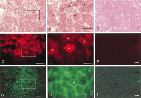 Representative images of Evans blue dye (EBD) stained area. A, B:... | Download Scientific Diagram