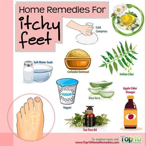 Home Remedies for Itchy Feet | Top 10 Home Remedies Migraines Remedies ...