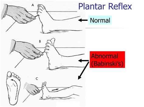 PPT - What are the major components of a spinal nerve? PowerPoint Presentation - ID:314033