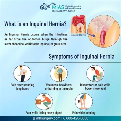 Inguinal Hernia Signs And Symptoms, Types, Causes, Risk, 47% OFF