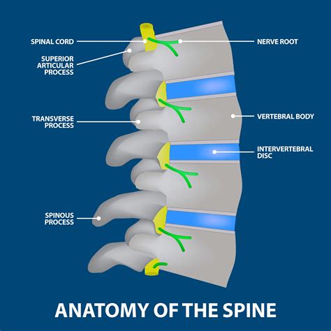 Discitis Symptoms | Florida Orthopaedic Institute