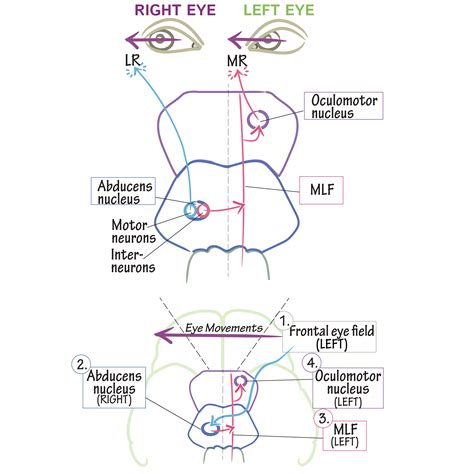 Neuroanatomy Glossary: Internuclear Ophthalmoplegias | ditki medical ...