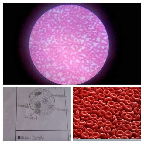 BIologi: Tugas 3: JARINGAN DARAH