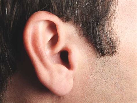 Red Ears: Causes, Treatments, and More