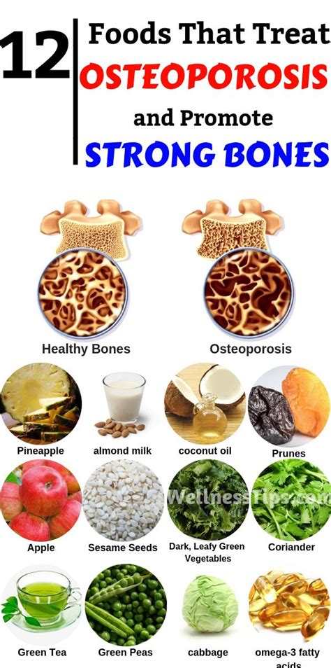 12 Foods That Treat Osteoporosis and Promote Strong Bones! | Diet and nutrition, Health food ...