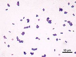 Staphylococcus aureus - Wikipedia, den frie encyklopædi